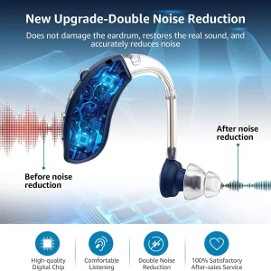 Audífono Retroauricular BTE para usar en cualquier Oido G25